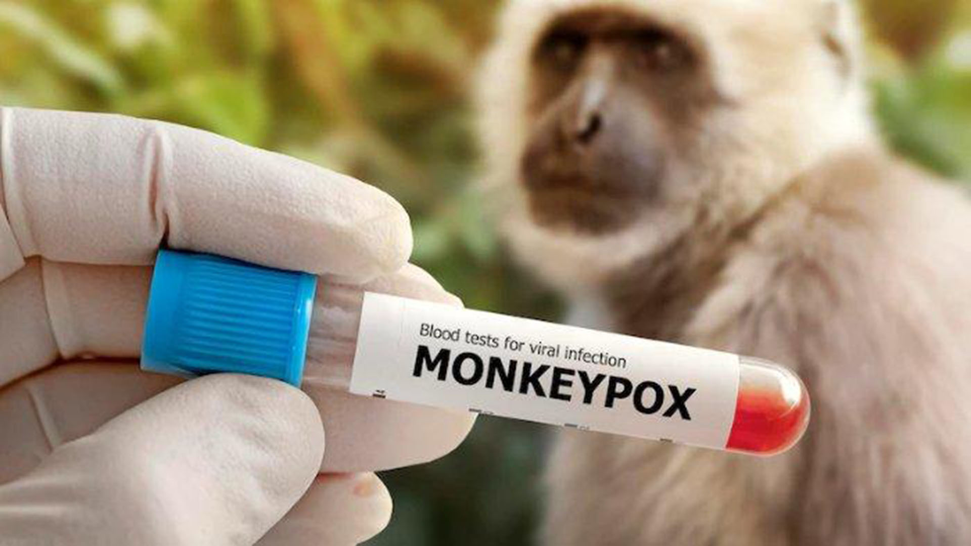 Mulai Masuk ke Indonesia, Apa Penyakit Cacar Monyet Bisa disembuhkan?