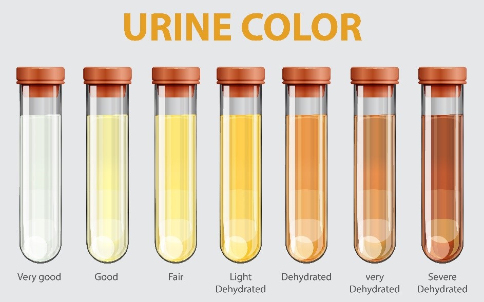 warna_urine.jpg